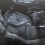 Blog Echo